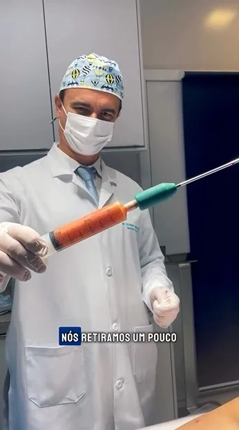 Rejuvenescimento Facial — Lifting